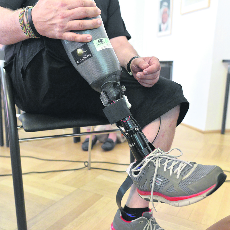 World's first ‘feeling' prosthetic leg offers new hope to amputees