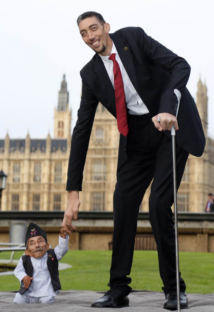 World's shortest man dies from pneumonia at 75 - Daily Sabah