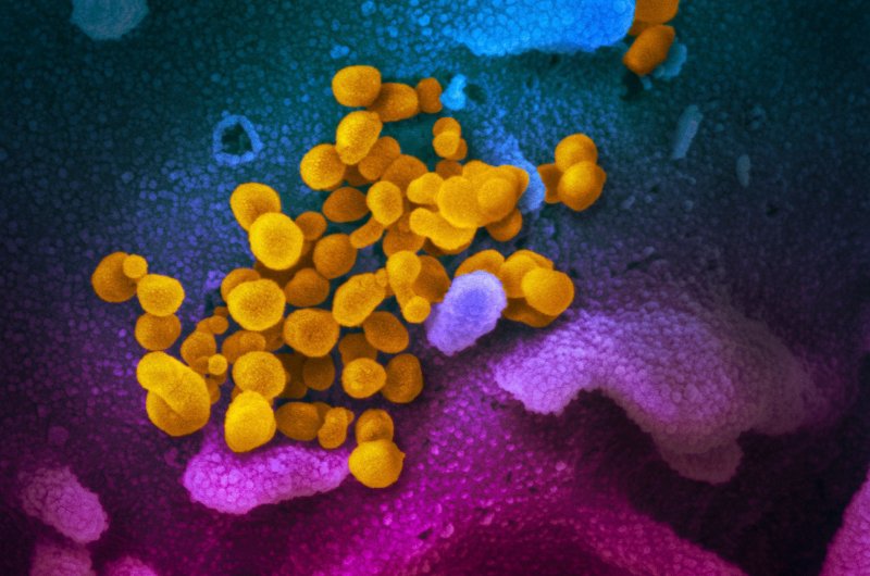 This handout illustration image obtained February 27, 2020 courtesy of the National Institutes of Health taken with a scanning electron microscope  shows SARS-CoV-2 (yellow) — also known as 2019-nCoV, the virus that causes COVID-19—isolated from a patient in the US, emerging from the surface of cells (blue/pink) cultured in the lab. (Photo by Handout / National Institutes of Health / AFP)