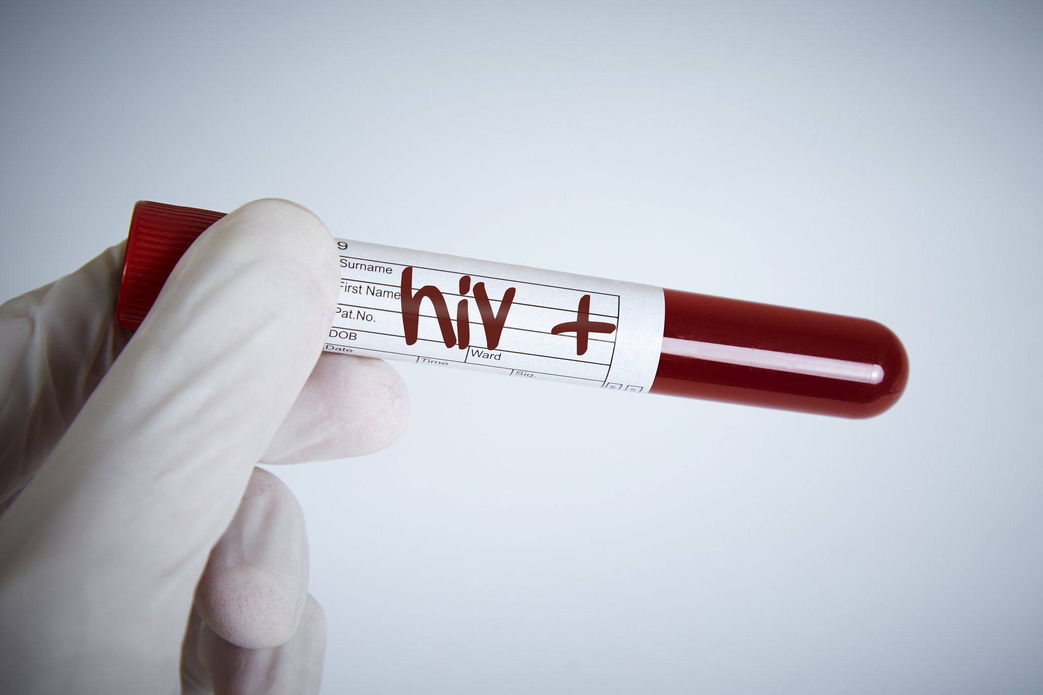 More than 34 million people are believed to have been infected with HIV. (iStock Photo)