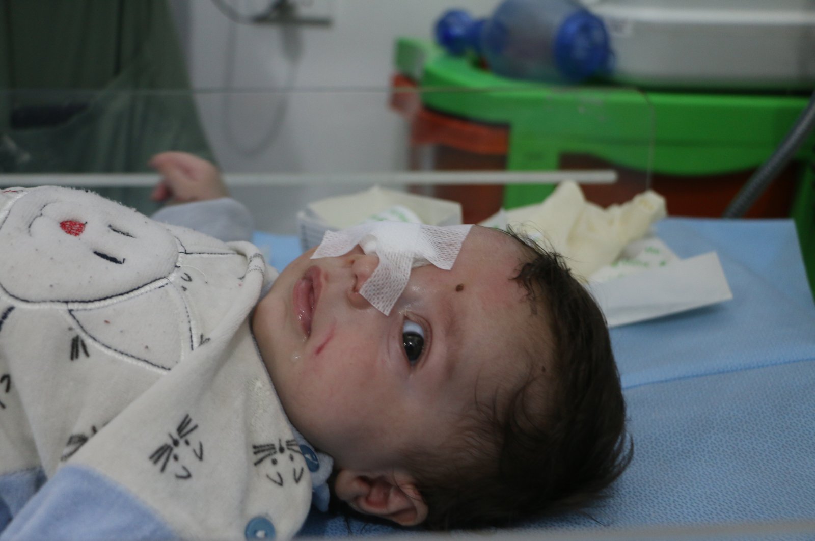 Two-month-old Abdurrahman's right eye was heavily injured when a rocket fired by Syrian regime forces struck his family's home, Tuesday, March 17, 2020. (AA)