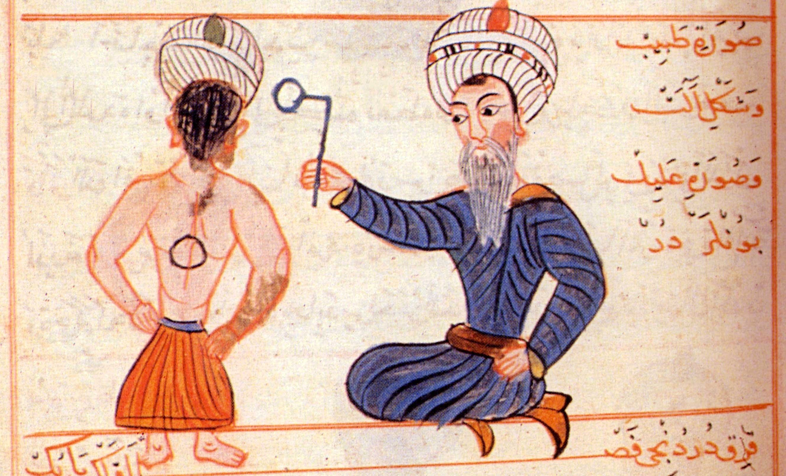 An illustration by Şerafeddin Sabuncuoğlu depicting a treatment method with branding iron.