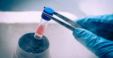 A liquid nitrogen bank containing a suspension of stem cells. (Sabah File Photo)