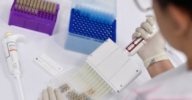 Countries around the world are racing to find a vaccine for coronavirus. (AFP Photo)