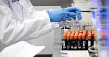 A staff member wearing protective gloves works in the Microvida medical laboratory, at Bravis hospital in Roosendaal, The Netherlands, Tuesday, March 31, 2020. (EPA Photo)