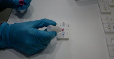 The new COVID-19 test, seen in this undated photo, will rely on "immunofiltration" and will yield results within five minutes, Türklab says. (AA Photo)