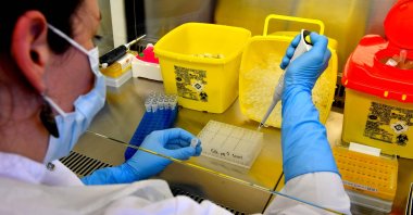 A lab assistant manipulates samples, at a COVID-19 screening centre of Saint Andre Hospital in Bordeaux, France on May 20, 2020. (AFP Photo)