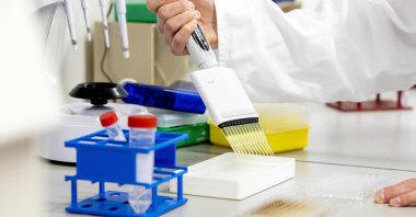 A researcher works in the laboratory of the Amsterdam UMC, in Amsterdam, the Netherlands, May 28, 2020. (AFP Photo)