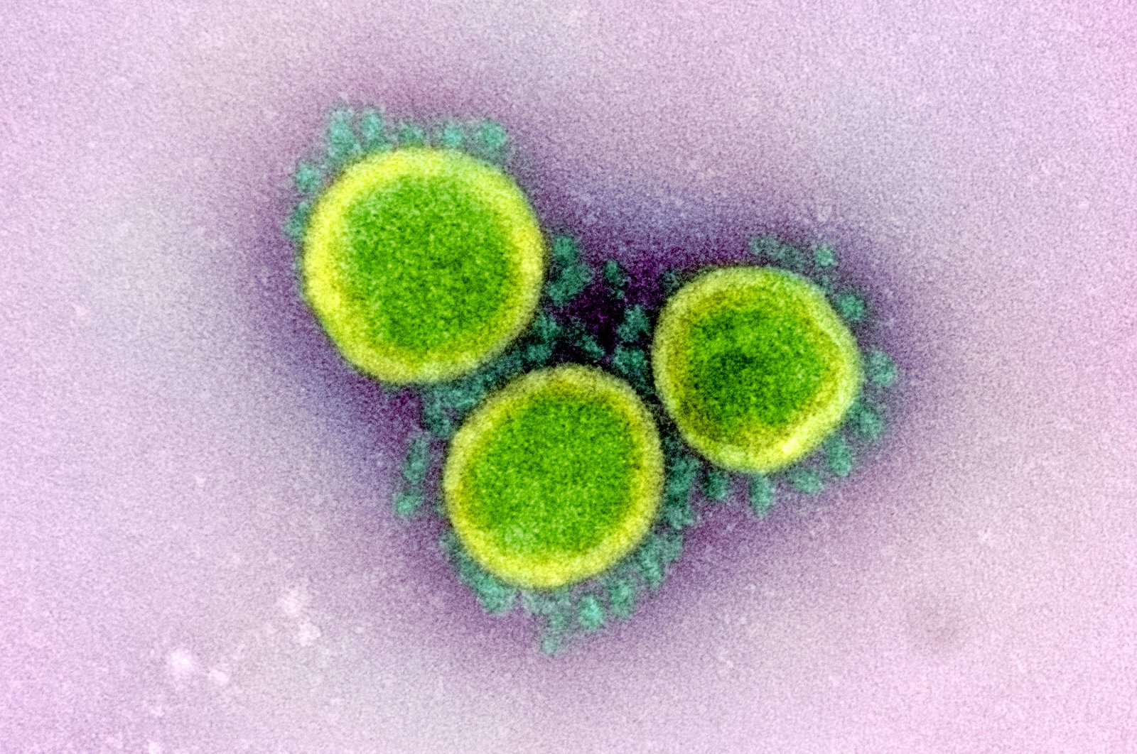 An undated transmission electron micrograph of SARS-CoV-2 virus particles isolated from a patient. NIAID Integrated Research Facility (IRF)/Handout via REUTERS