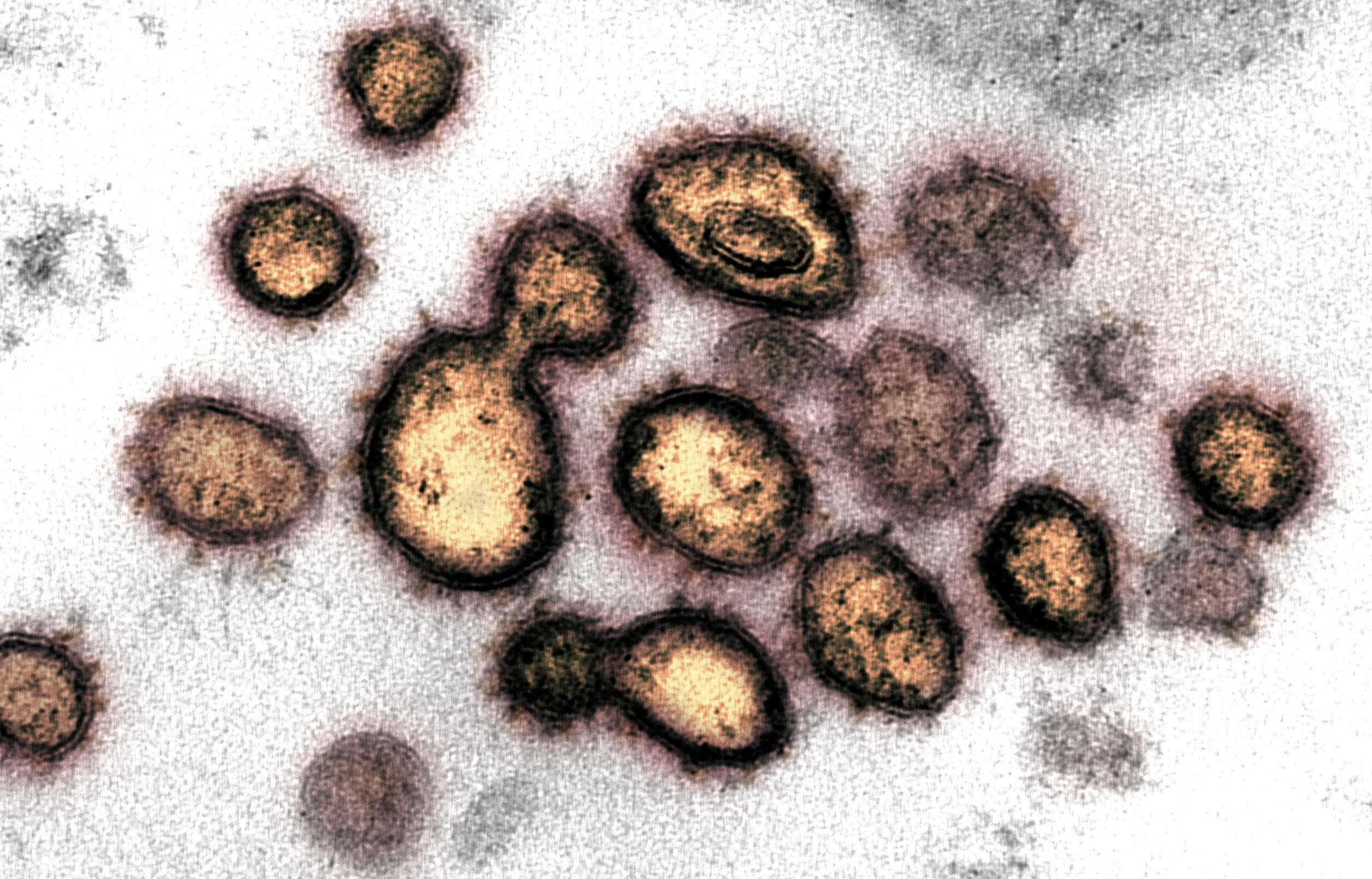 This transmission electron microscope image shows SARS-CoV-2 isolated from a patient in the U.S. (NIAID-RML/Handout via REUTERS)