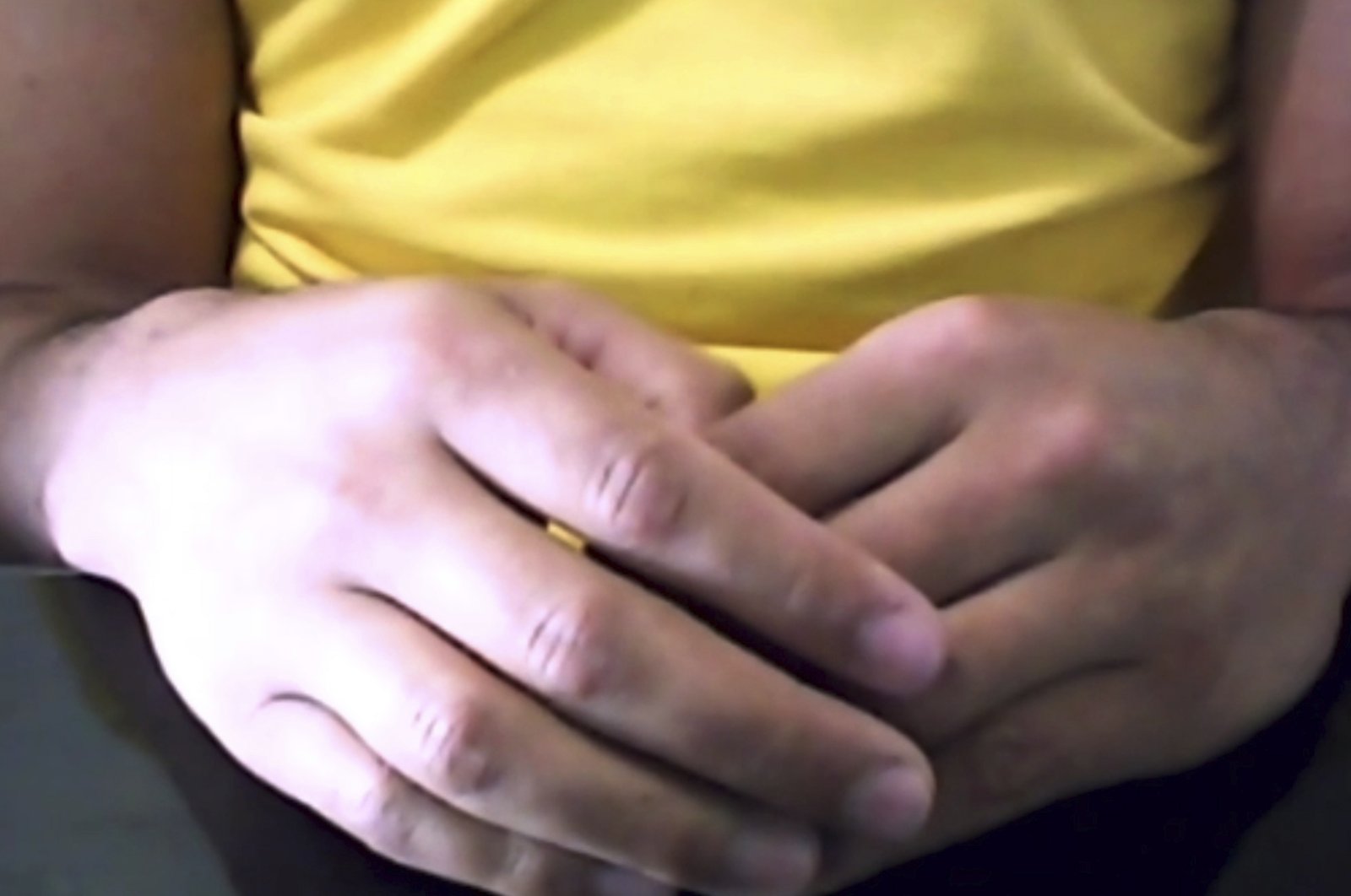 This image made from a video shows the hands of a Brazilian man who was infected with the AIDS virus and has shown no sign of it for more than a year since he stopped HIV medicines after an intense experimental drug therapy aimed at purging the dormant virus from his body, July 7, 2020. (AP Photo)