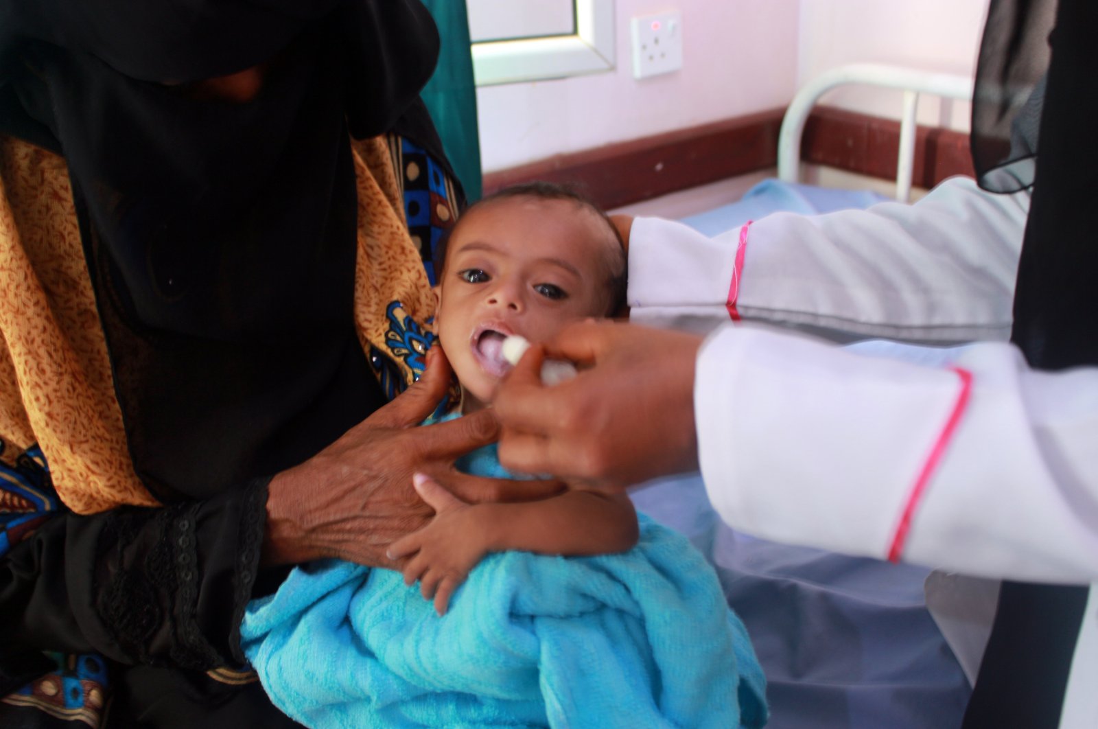 A nurse cares for a Yemeni child suffering from malnutrition, at a treatment center in Yemen's northern Hajjah province, July, 5, 2020. (AFP Photo)