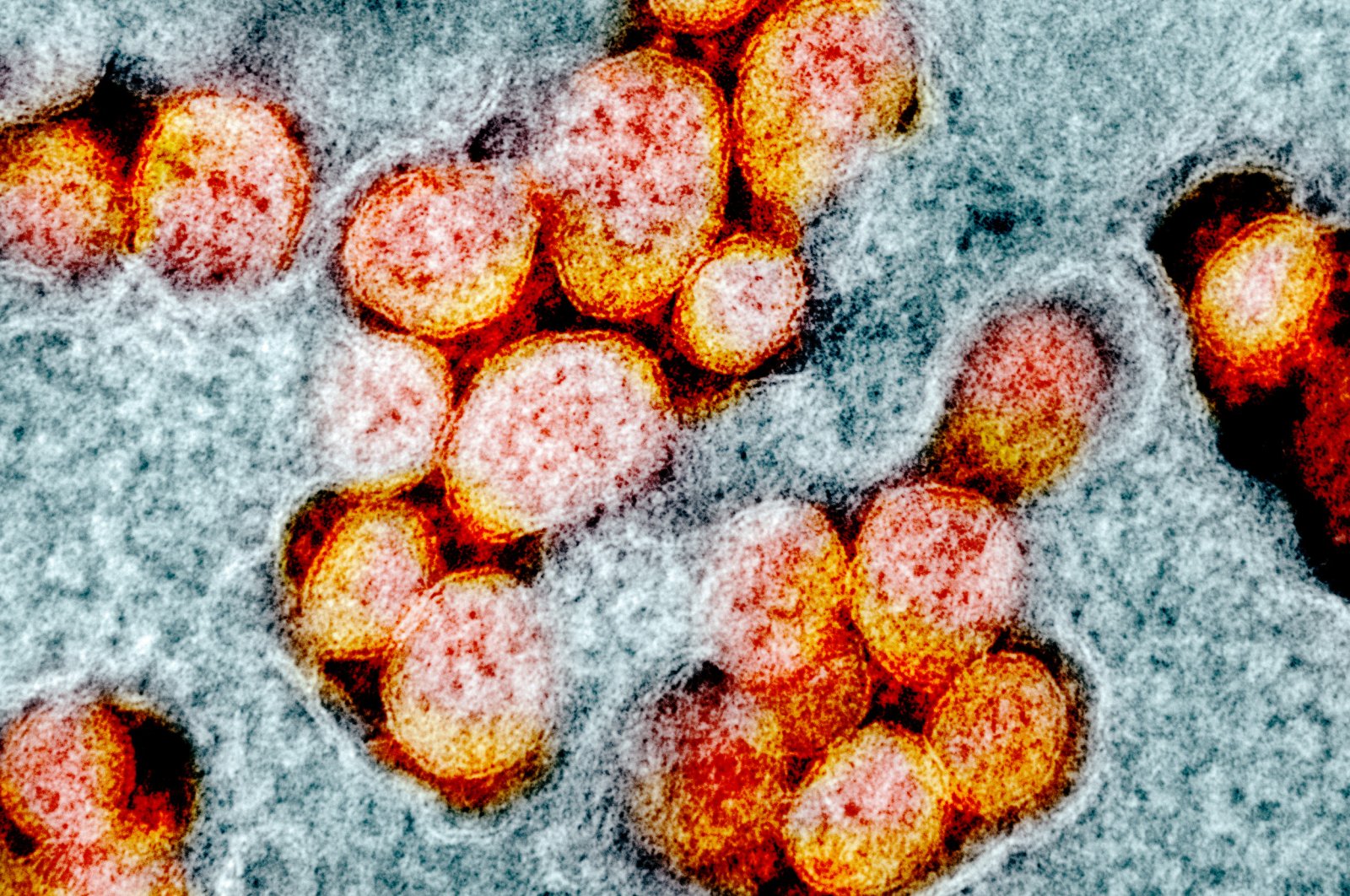 An undated transmission electron micrograph of SARS-CoV-2 shoıws virus particles isolated from a patient. (NIAID Integrated Research Facility (IRF)/Handout via REUTERS)