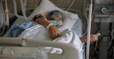 A patient suffering from the coronavirus disease (COVID-19) lies in bed at University Hospital Medical Center Bezanijska kosa in Belgrade, Serbia, July 25, 2020. (Reuters Photo)
