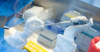 A scientist prepares samples during the research and development of a vaccine against the coronavirus at a laboratory in Saint Petersburg, Russia, June 11, 2020. (Reuters Photo)