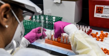 A lab technician sorts blood samples inside a lab for a COVID-19 vaccine study at the Research Centers of America (RCA) in Hollywood, Florida, U.S., Aug. 13, 2020. (AFP Photo)