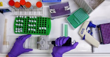 A scientist prepares protein samples for analysis in a lab at the Institute of Cancer in Sutton, England on July 15, 2013. (Reuters Photo)
