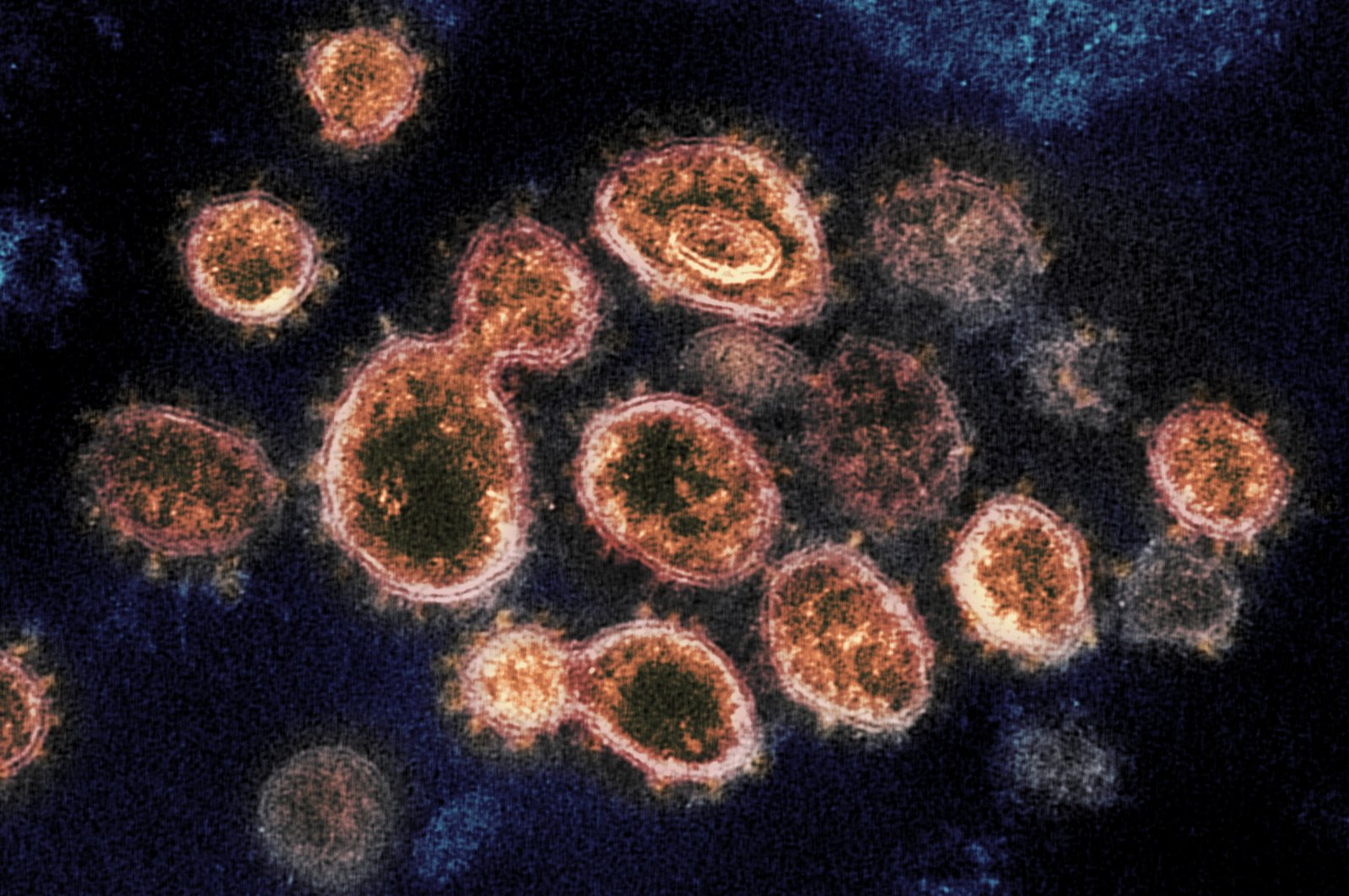 This electron microscope image shows SARS-CoV-2 virus particles which causes COVID-19, isolated from a patient in the U.S., emerging from the surface of cells cultured in a lab. (NIAID-RML via AP Photo)