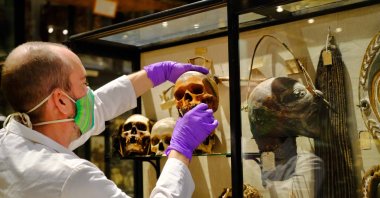 In this image taken in July 2020 and made available by Pitt Rivers Museum, a skull is removed from the Treatment of Dead Enemies case at the Pitt Rivers Museum, part of the University of Oxford, Oxford, England. (AP PHOTO)