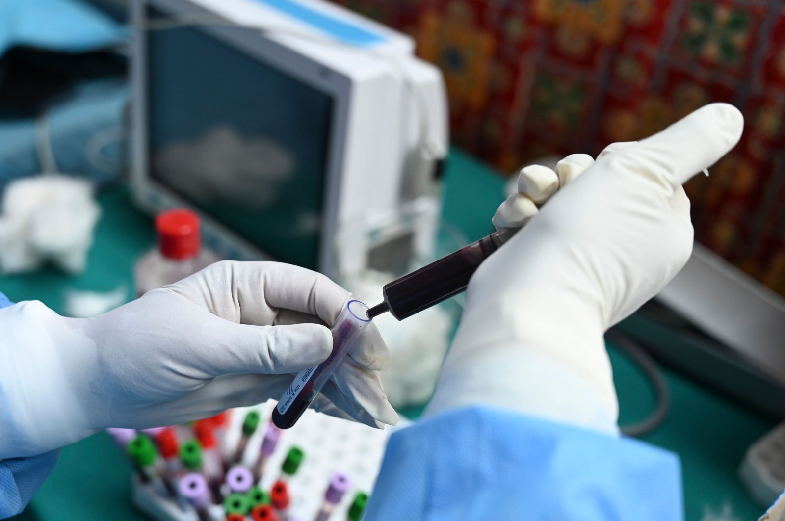 A health worker transfers in a test tube a blood sample donated by a recovered COVID-19 coronavirus patient for plasma at a donation camp in Srinagar, Indian-administered Jammu and Kashmir, July 22, 2020. (AFP Photo)