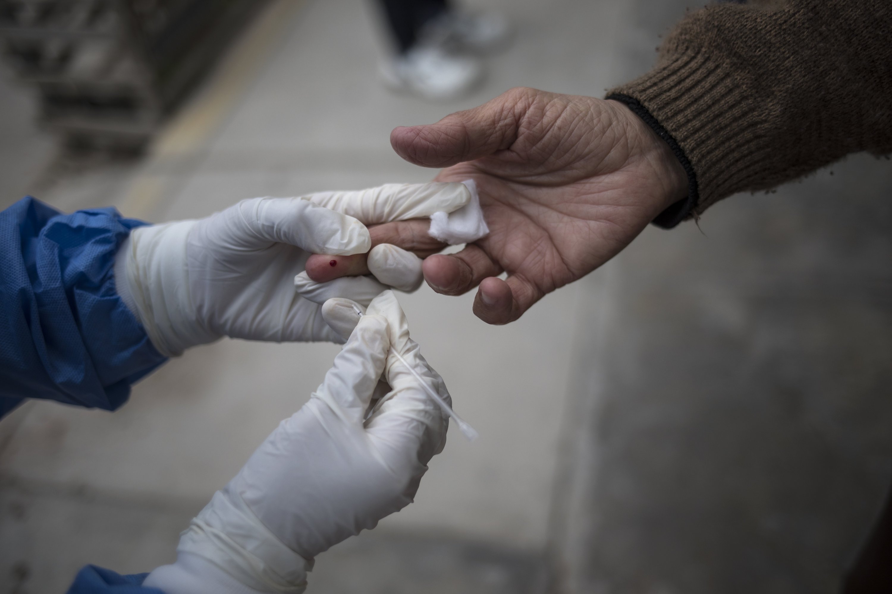 A healthcare worker takes a blood sample during a house-to-house rapid antibody test drive in Villa el Salvador, on the outskirts of Lima, Peru, June 30, 2020. (AP Photo)
