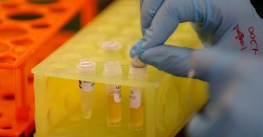 A lab technician works to develop a COVID-19 antibody, San Diego, California, U.S., May 22, 2020. (Reuters Photo)