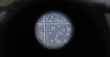 Cells seen through the eyepiece of a microscope counted by a research technician in the laboratory at Imperial College in London, July 30, 2020. (AP Photo)