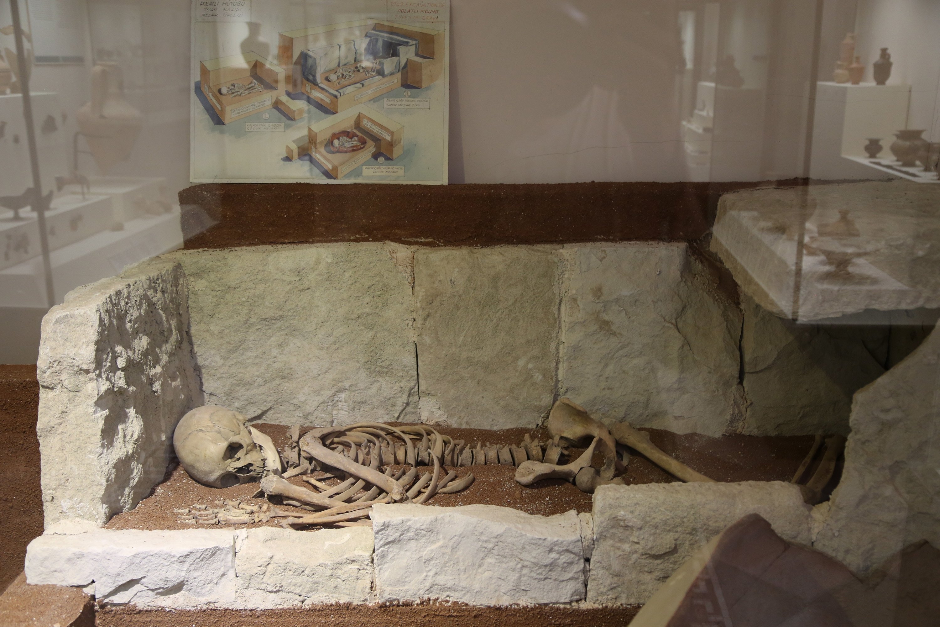 A human skeleton at the Gordion Museum and Archaeological Site in Ankara, Sept. 11, 2015. (Shutterstock Photo)
