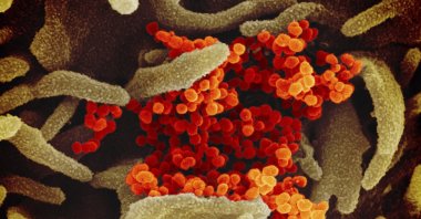 This file image shows SARS-CoV-2 (orange) İsolated from a patient in the U.S., emerging from the surface of cells (green) cultured in the lab. (NIAID-RML via AP)