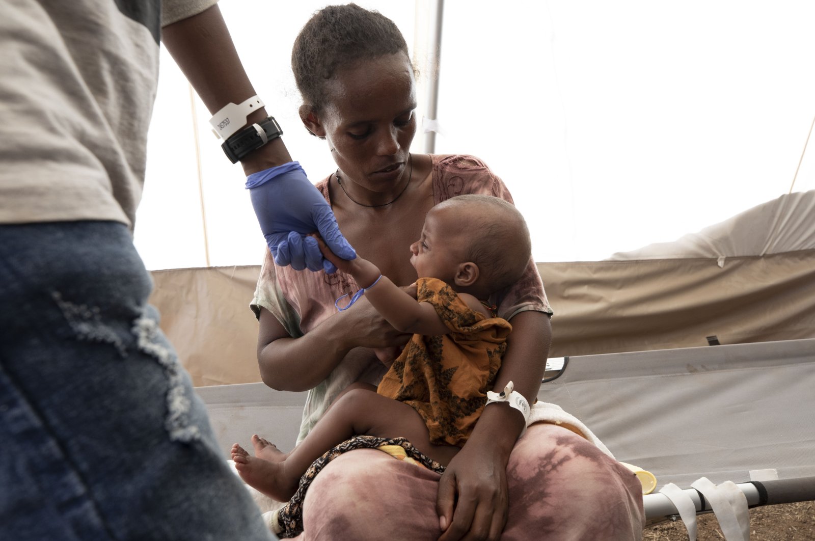 A woman holds her malnourished and severely dehydrated baby at the Medecins Sans Frontieres (MSF) clinic at Umm Rakouba refugee camp in Qadarif, eastern Sudan, Dec. 5, 2020. (AP Photo)