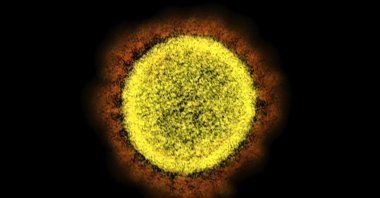 This 2020 electron microscope image made available by the National Institute of Allergy and Infectious Diseases shows a SARS-CoV-2 particle isolated from a patient, in a laboratory in Fort Detrick, Maryland, U.S. (NIAID/NIH via AP)