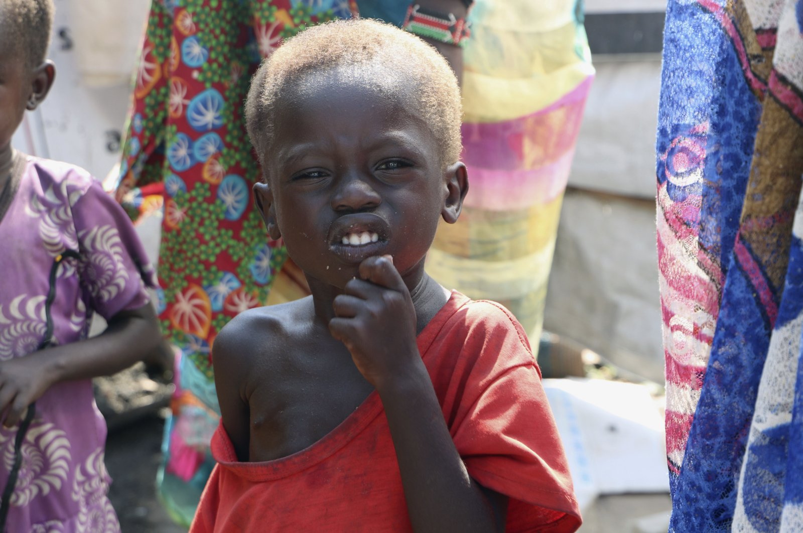 Three-year-old Peter Sebit stands outside a health clinic waiting to receive food supplements in Pibor, South Sudan, Dec. 17, 2020. (AP Photo)