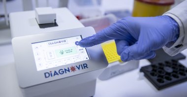 A view of the Diagnovir device developed by Turkish scientists, in the capital Ankara, Turkey, Dec. 31, 2020. (AA PHOTO)