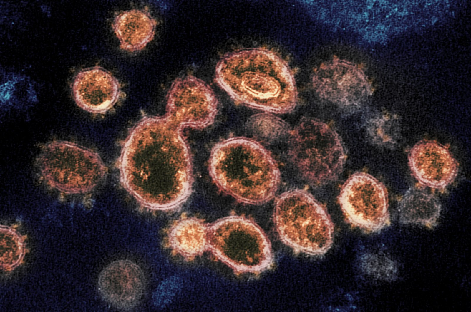 Electron microscope image shows SARS-CoV-2 virus particles which cause COVID-19, isolated from a patient in the U.S., Dec. 24, 2020. (AP Photo)
