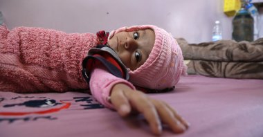 A malnourished Yemeni child lies on a bed while receiving treatment at a hospital in Sanaa, Yemen, Jan. 26, 2021. (Photo by Getty Images)