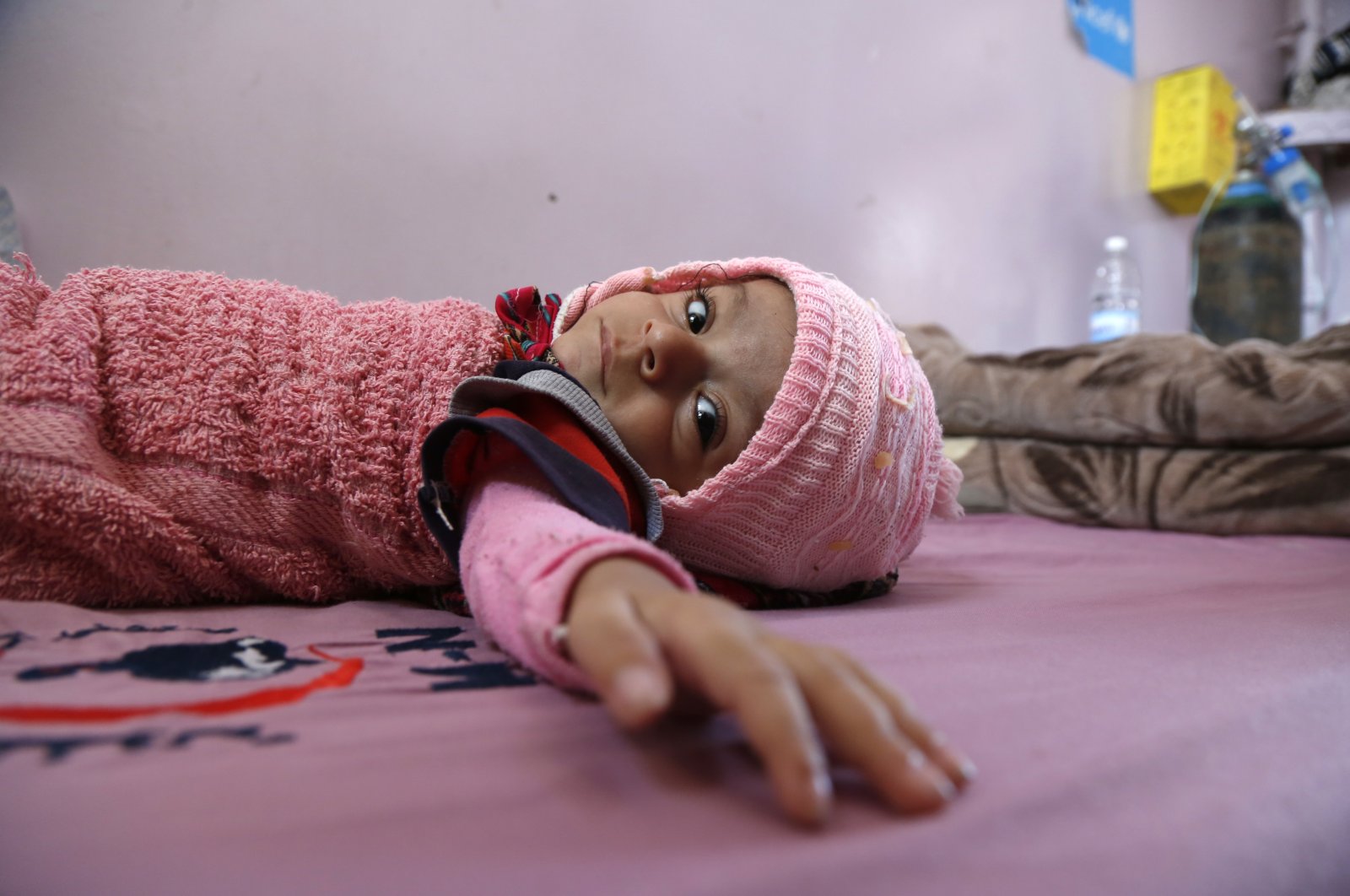 A malnourished Yemeni child lies on a bed while receiving treatment at a hospital in Sanaa, Yemen, Jan. 26, 2021. (Photo by Getty Images)