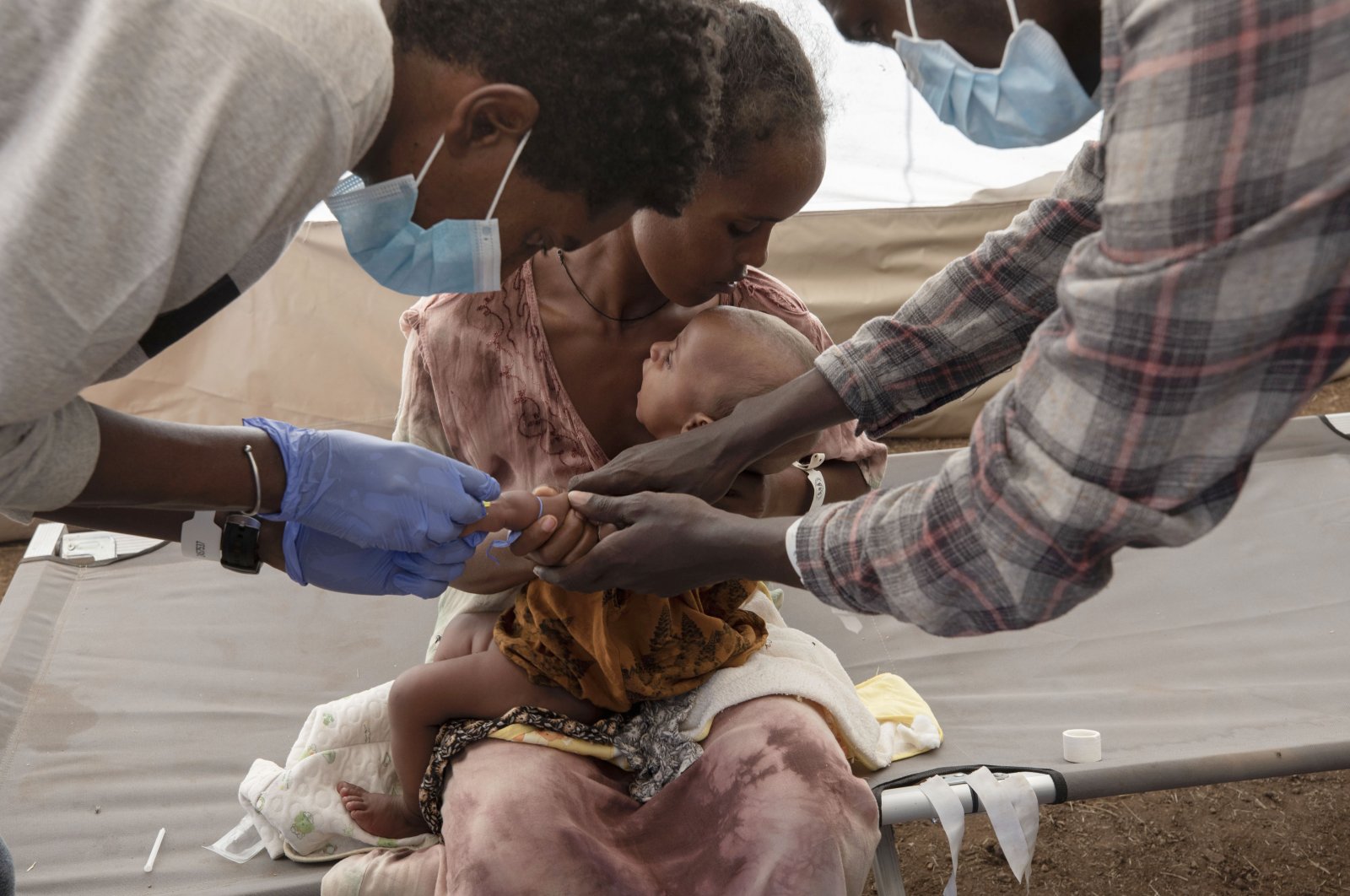 A Tigray woman who fled the conflict in Ethiopia's Tigray region, holds her malnourished and severely dehydrated baby as nurses give him IV fluids, at the Medecins Sans Frontieres (MSF) clinic, at Umm Rakouba refugee camp in Qadarif, eastern Sudan, Dec. 5, 2020. (AP Photo)