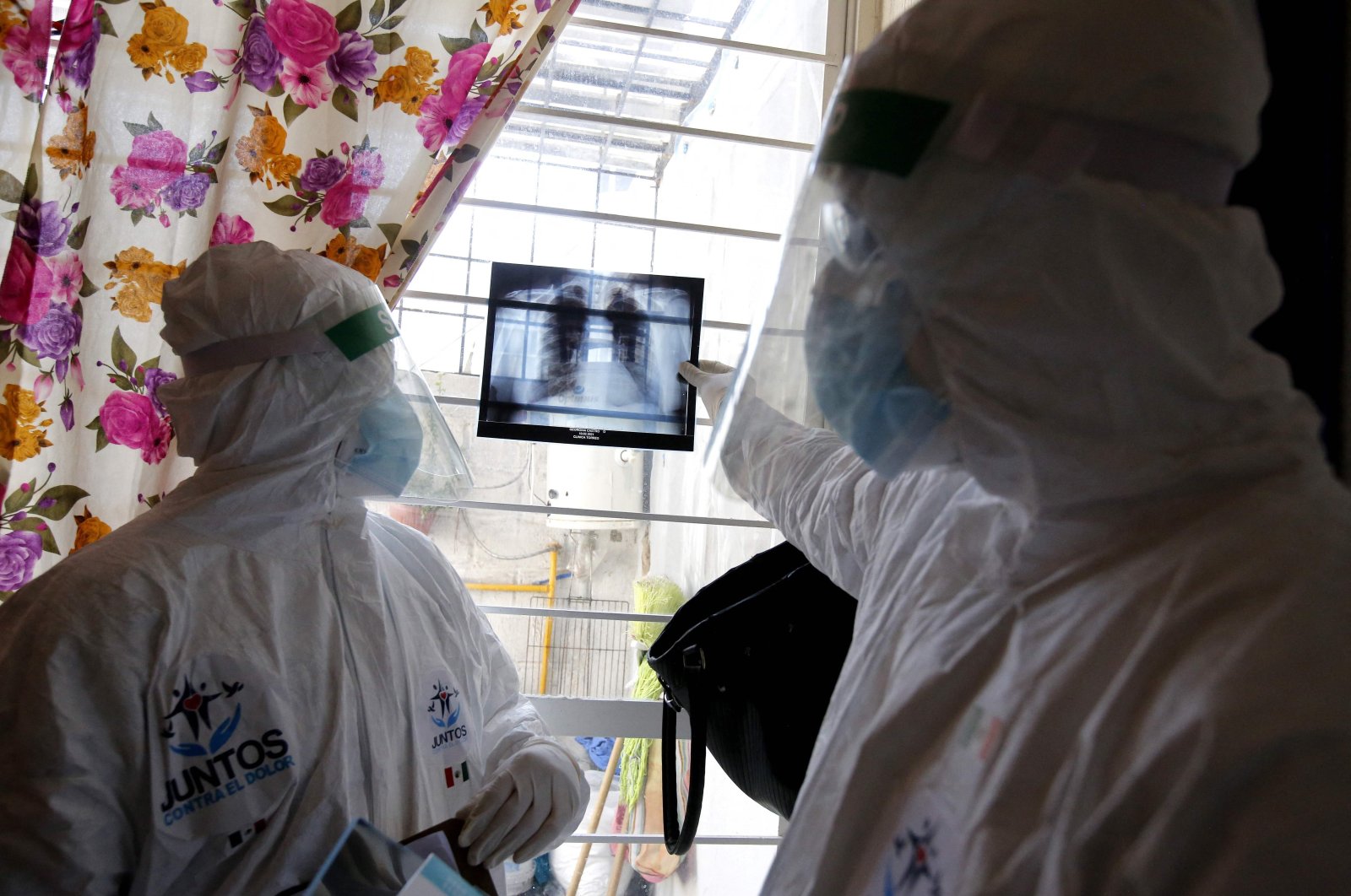 Volunteer doctors look at the lung X-ray of a person infected with COVID-19 at his house in Juanacatlan, state of Jalisco, Mexico, Feb. 18, 2021. (AFP Photo)