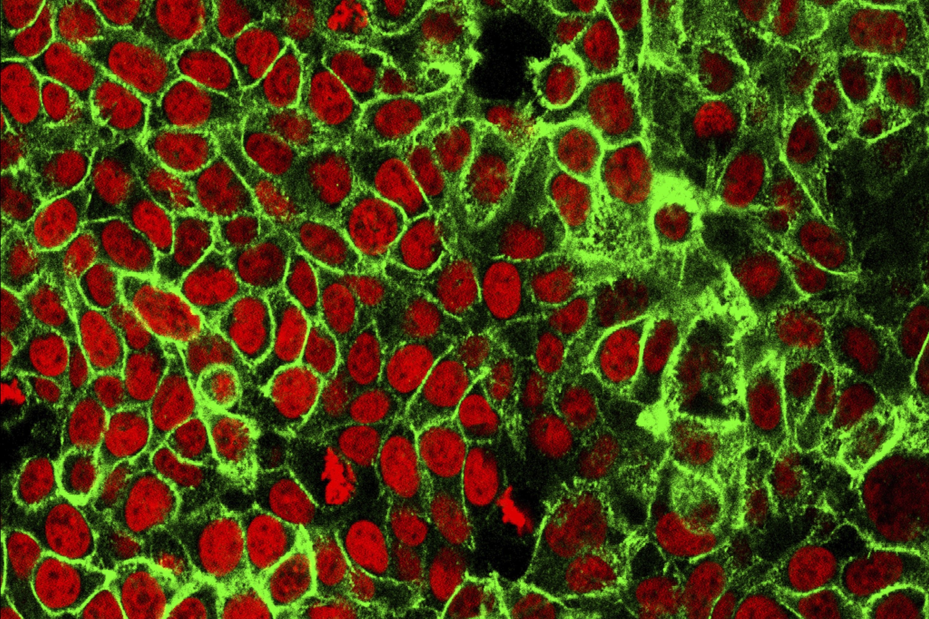 ภาพจากกล้องจุลทรรศน์นี้แสดงเซลล์มะเร็งลำไส้ของมนุษย์ที่มีนิวเคลียสย้อมสีแดง  (ภาพโดยสถาบันมะเร็งแห่งชาติศูนย์วิจัยมะเร็งปี 2558)