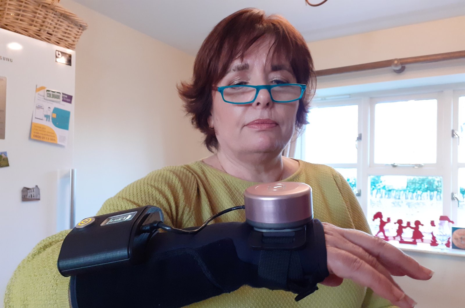 Business analyst Jenny Field wears a glove with a built-in spinning gyroscope that helps people with Parkinson's disease and essential tremor stop their hands from shaking, at her home near Towcester, Britain, Dec. 15, 2020. (REUTERS Photo)