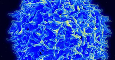 A scanning electron micrograph of a human T lymphocyte (also called a T cell) from the immune system of a healthy donor, in this National Institute of Allergy and Infectious Disease (NIAID) handout photo obtained March 30, 2021. (Photo by Handout / National Institute of Allergy and Infectious Diseases / AFP) 