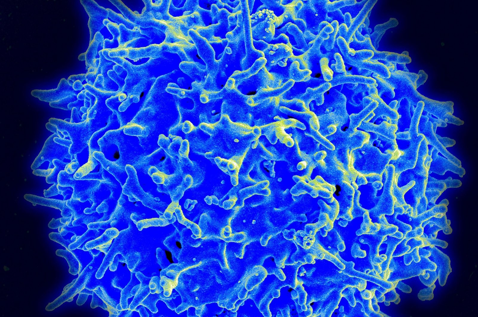 A scanning electron micrograph of a human T lymphocyte (also called a T cell) from the immune system of a healthy donor, in this National Institute of Allergy and Infectious Disease (NIAID) handout photo obtained March 30, 2021. (Photo by Handout / National Institute of Allergy and Infectious Diseases / AFP) 