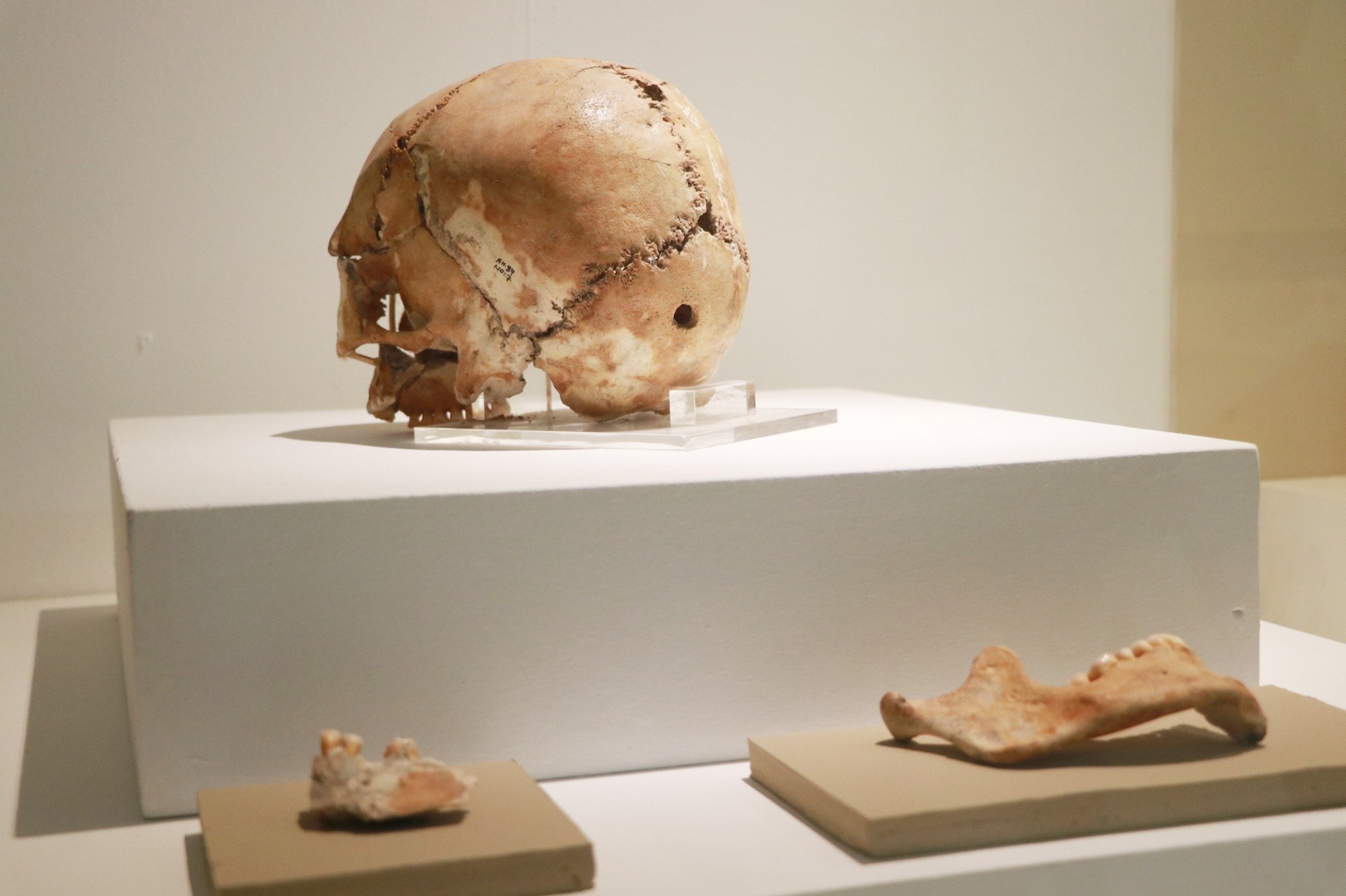 The skull of the young woman who underwent the first brain surgery in Aşıklı Höyük on display at Aksaray Museum, Aksaray, Turkey, May 1, 2021. (IHA Photo)