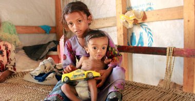 Hashem Mahmoud Atin, a 10-month-old displaced Yemeni child suffering from acute malnutrition, in the arms of a sibling, at a camp in Hajiah, Yemen, Sept. 3, 2020. (AFP PHOTO)