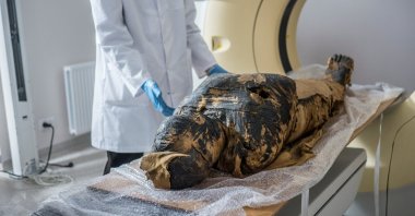 This handout picture made available by the Warsaw Mummy Project on April 29, 2021 shows the pregnant Egyptian mummy being prepared for X-Ray images taken on December 15, 2015, at a medical center in Otwock near Warsaw, Poland. (REUTERS Photo) 