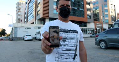 Cengiz Balcı shows a photo of the severed fingers he found, in Adana, southern Turkey, May 11, 2021. (DHA PHOTO)