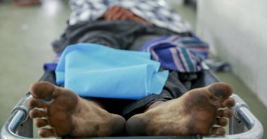 The body of a man who a doctor said was shot and killed by Myanmar security forces during an anti-military takeover protest, lies on a stretcher in Mandalay, Myanmar, March 23, 2021. (AP Photo)