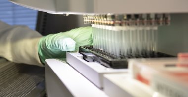 A researcher works on the development of the medication aducanumab in Cambridge, Massachusetts, U.S. (Biogen via AP)