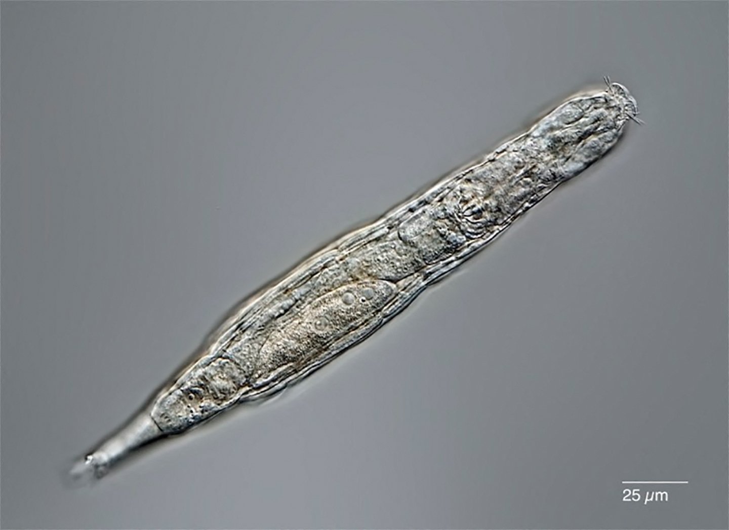 An up-close image shows a rotifier, a microscopic animal. (Michael Plewka via AFP)