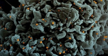 This photo provided by National Institute of Allergy and Infectious Disease (NIAID) shows a colorized scanning electron micrograph of a cell (teal) infected with U.K.'s B.1.1.7 variant of COVID-19 virus particles (orange), isolated from a patient sample, March 31, 2021. (NIAID via AFP)